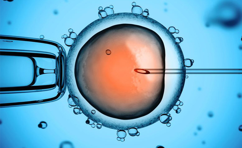 הפריה חוץ גופית - in vitro fertilization- IVF